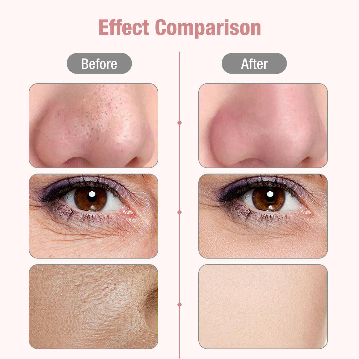Mubilux Ultrasone Nettoyeur de Peau Machine de Nettoyage Profond du Visage