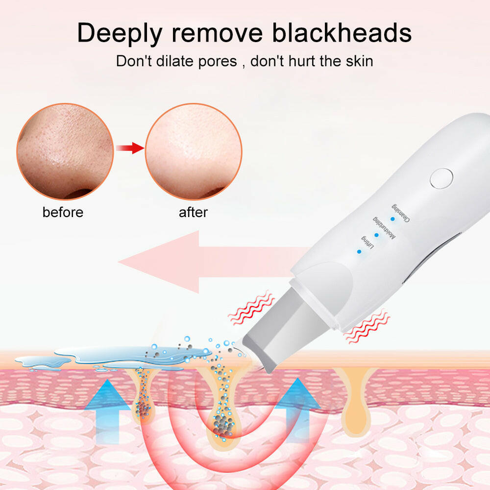 Mubilux Ultrasone Nettoyeur de Peau Machine de Nettoyage Profond du Visage